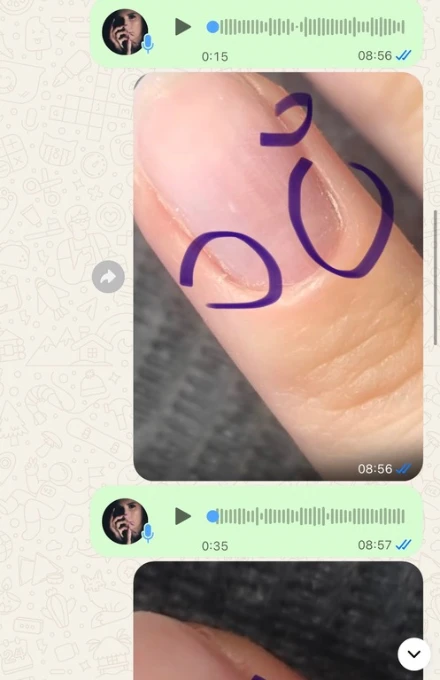 Fragment rozmowy z kursantką — zdjęcie paznokcia z zaznaczonymi poprawkami