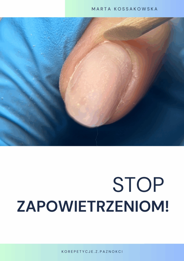 Stop zapowietrzeniom W1